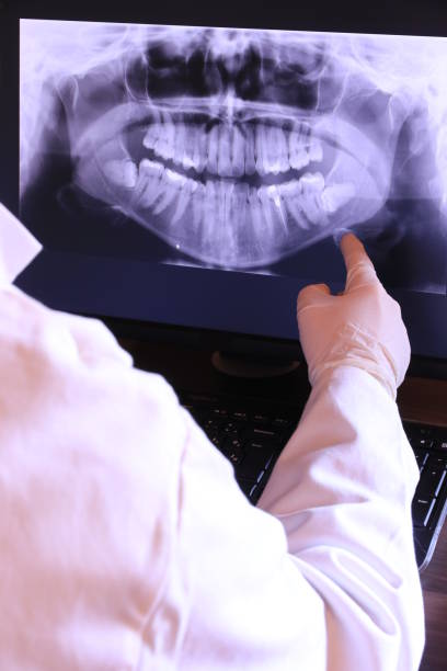 Best Knocked-Out Tooth (Avulsed Tooth) Treatment in Mazomanie, WI